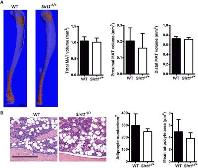 Sirt1 Promotes a Thermogenic Gene Program in Bone Marrow Adipocytes: From Mice to (Wo)Men